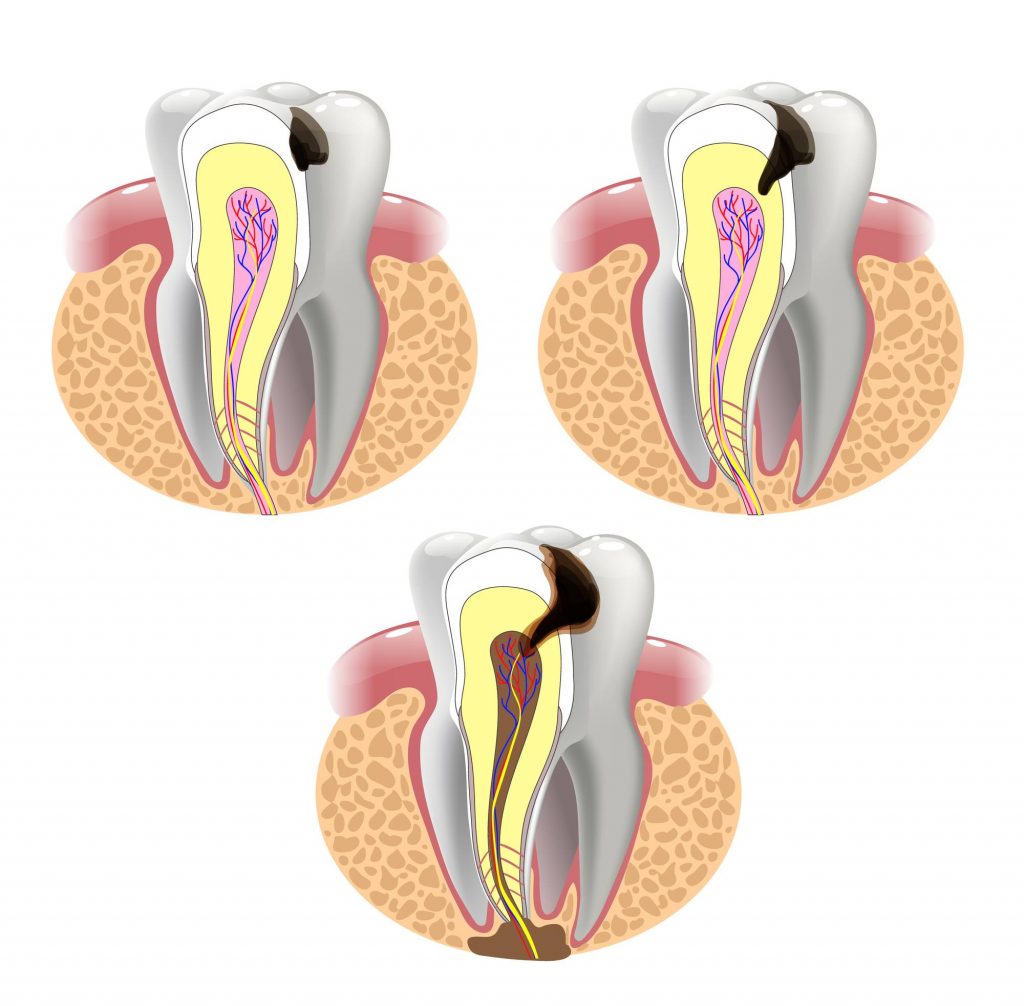 Dental Implant Solutions