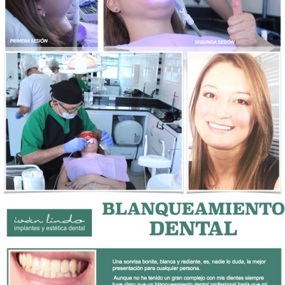 Teeth Whitening by DR. IVÁN LIND