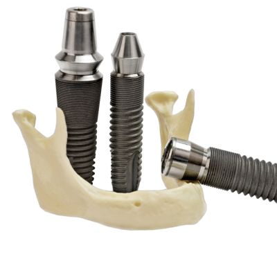 Implantes Dentales a Buen Precio