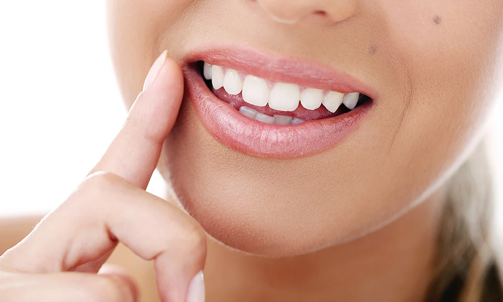 Mujer sonriendo enseñando el resultado de su cirugía de implantes dentales